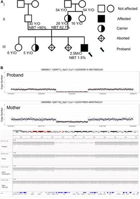 Chronic granulomatous disease associated with Duchenne muscular dystrophy caused by Xp21.1 contiguous gene deletion syndrome: Case report and literature review